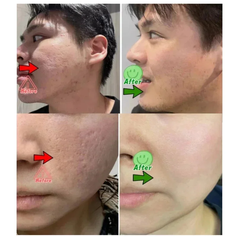 Salicylic Acid Pore Clearing C - Korean Skincare Routine ulasan dan harga