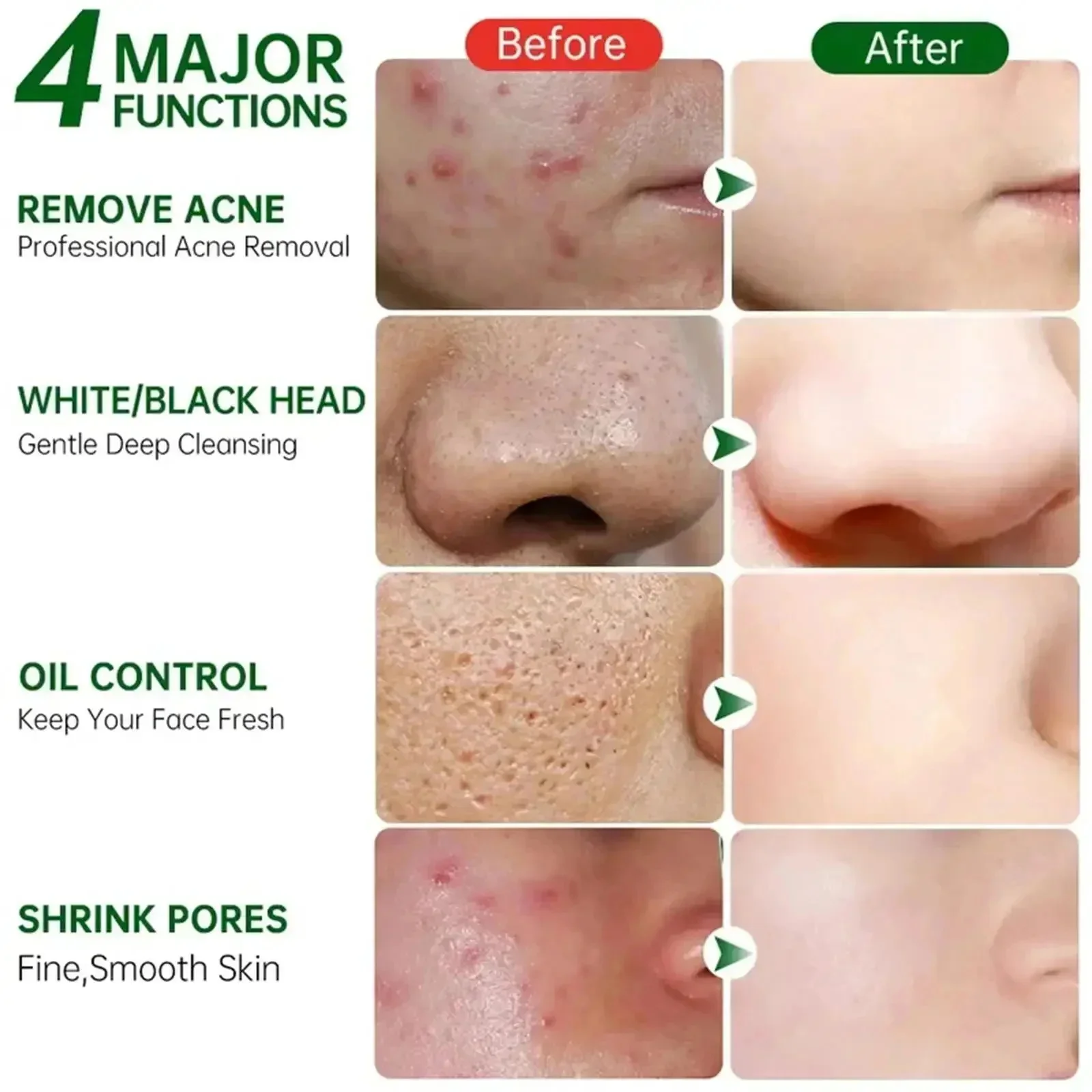 Salicylic Acid Pore Clearing C - Korean Skincare Routine ulasan dan harga