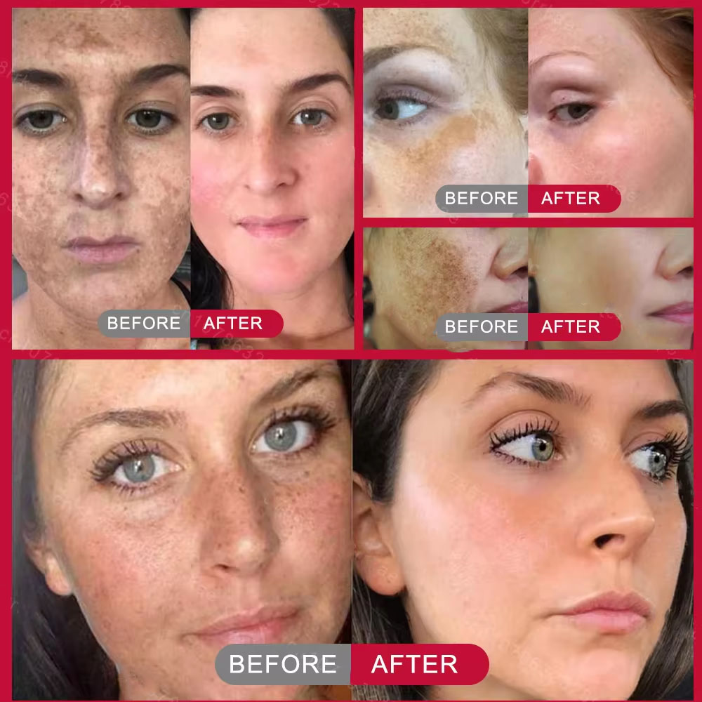 Powerful Spot-removing Whiteni - Korean Skincare Routine ulasan dan harga